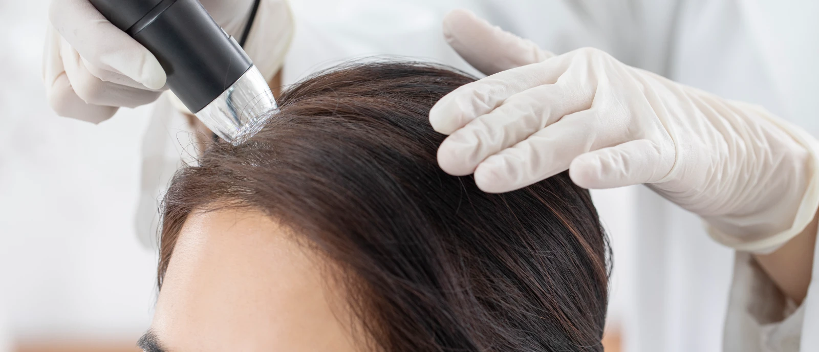 탈모클리닉 메인 이미지